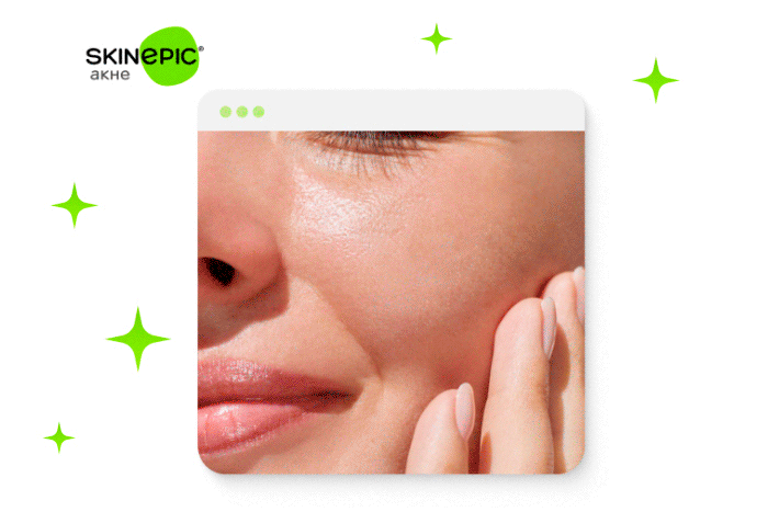 Skinepic – твой личный AI косметолог