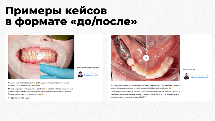 Простые кейсы в формате «до/после» наглядно показывают результат и хорошо работают для b2c-услуг. Пример с сайта «Легкой стоматологии».