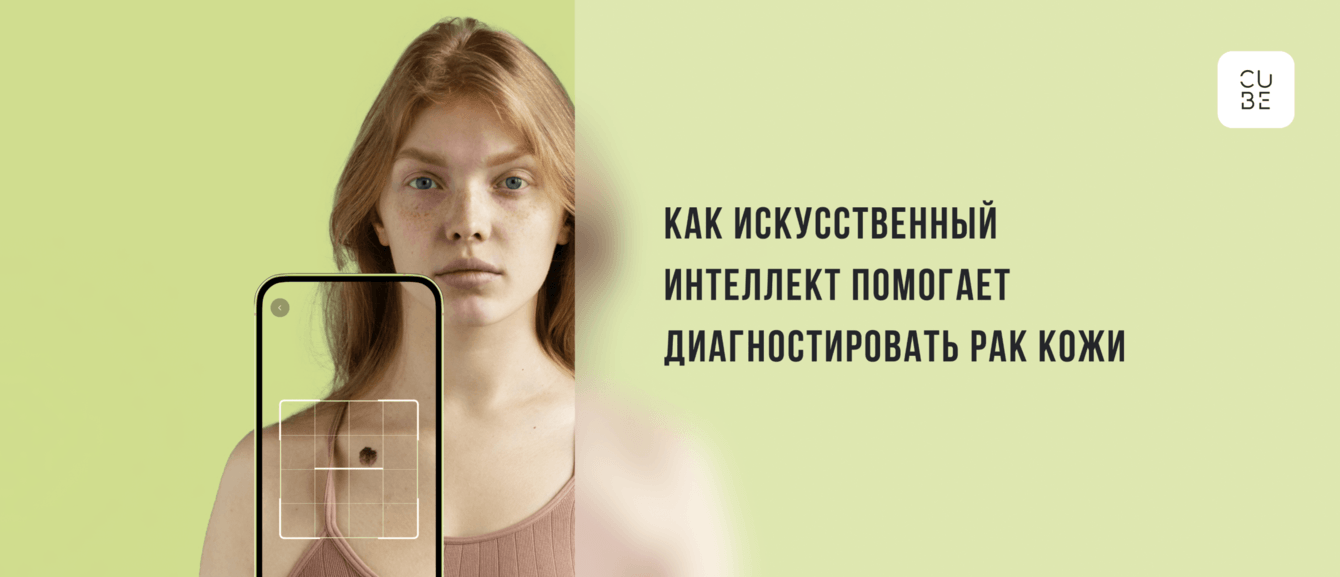 Приложение для диагностики рака кожи Cube
