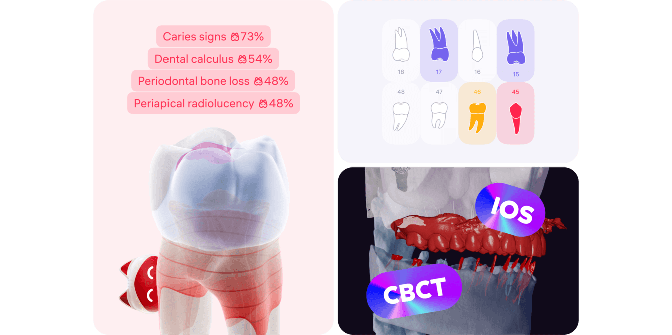 ИИ-сервис для стоматологов Diagnocat