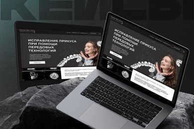 Dental Neo: как мы разработали лендинг для продвижения услуг по установке брекетов и элайнеров