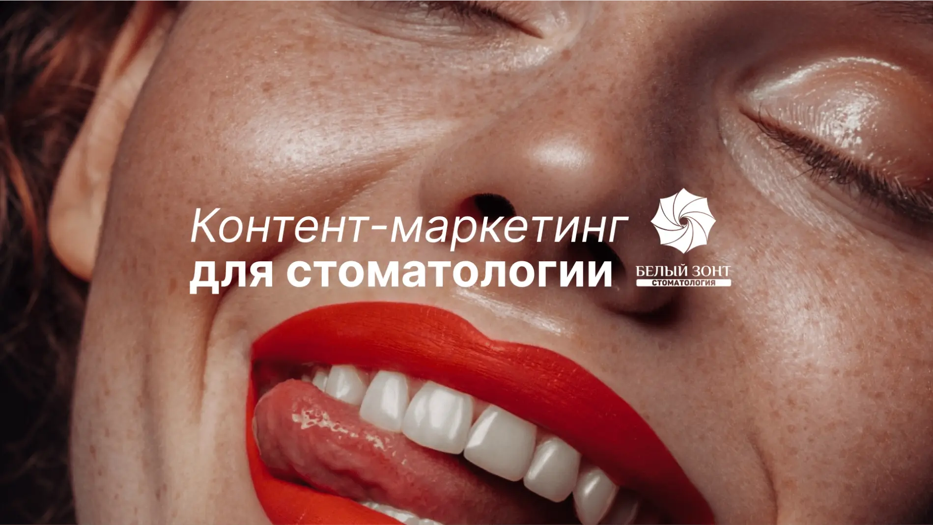 SMM для стоматологии. Кейс «Белый зонт»