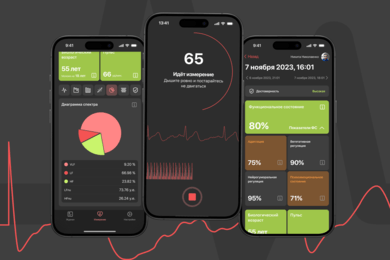 PulsePro. IOS приложение для получения данных о состоянии сердечно сосудистой системы.