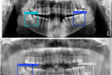 Кейс стоматологической клиники из г.Хэйхэ на AI:от снимка до КП без участия врача — конверсия +300%