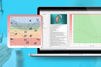 Разработка ПО для слухопротезистов: особенности функционала для настройки слуховых аппаратов