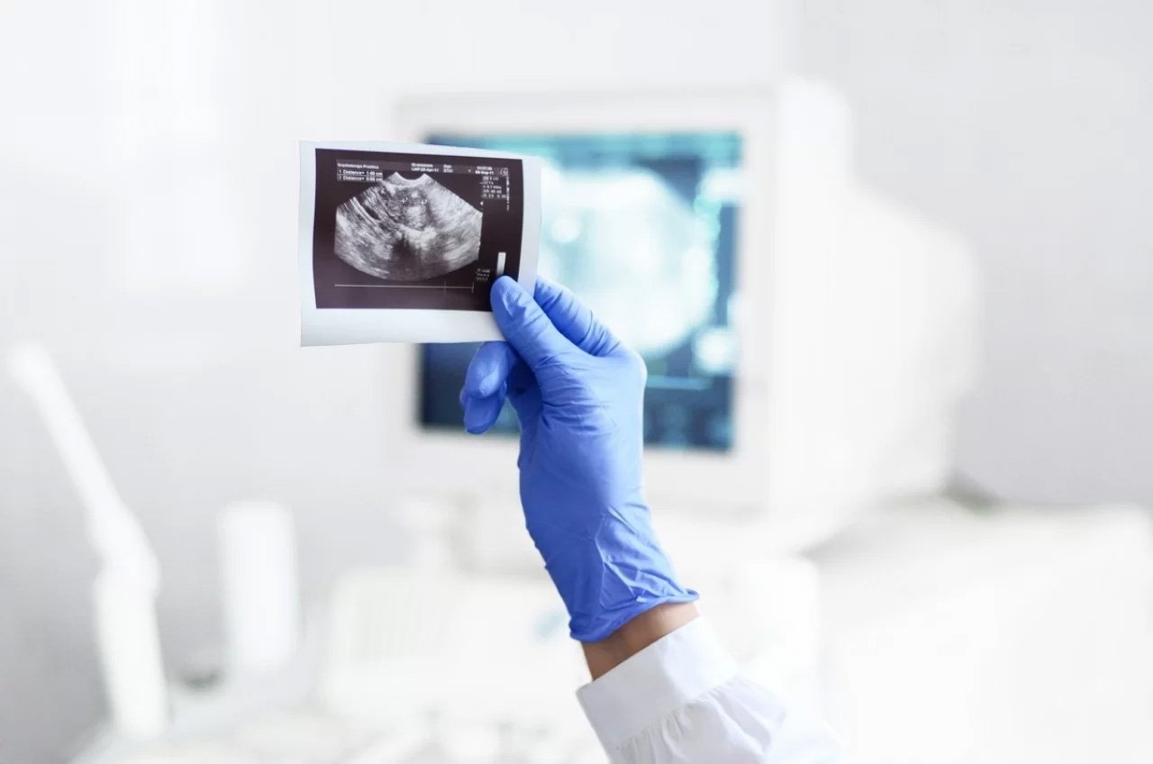 Интернет-магазин «УЗИ-МЕДИЦИНА»