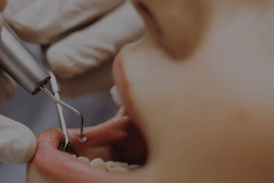 Как стоматологии увеличить число заявок с 5 до 144 за 5 месяцев на услугах с высоким чеком