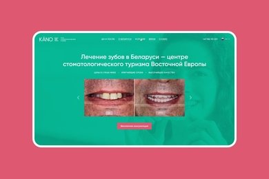 Лендинг презентации услуг стоматологии KANO в Норвегии