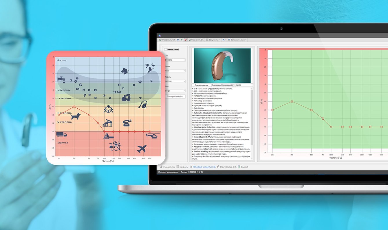 Разработка ПО для слухопротезистов: особенности функционала для настройки слуховых аппаратов