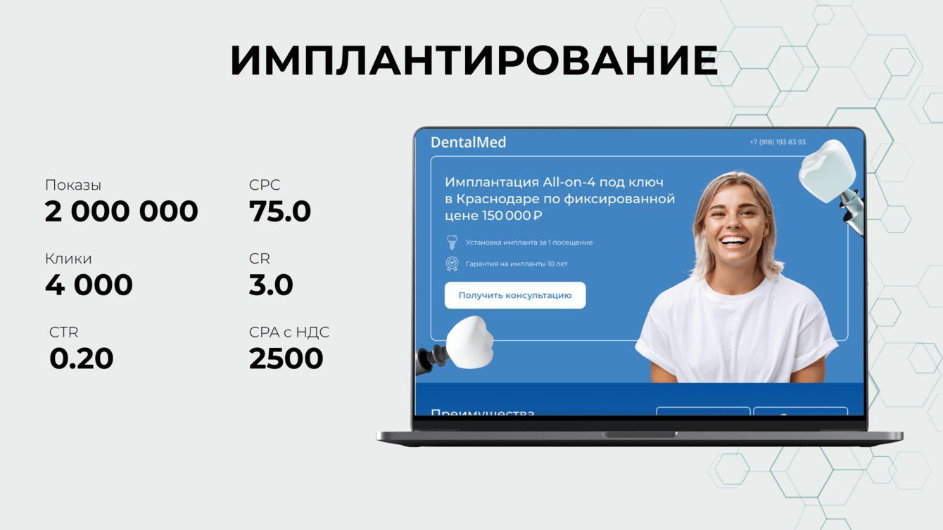 2 500 ₽ заявки на имплантацию : как выстроили поток с нуля