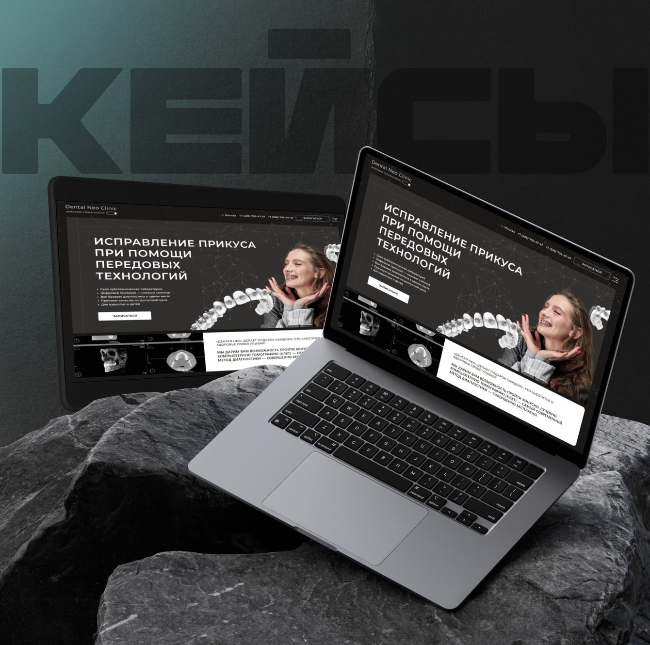 Dental Neo: как мы разработали лендинг для продвижения услуг по установке брекетов и элайнеров